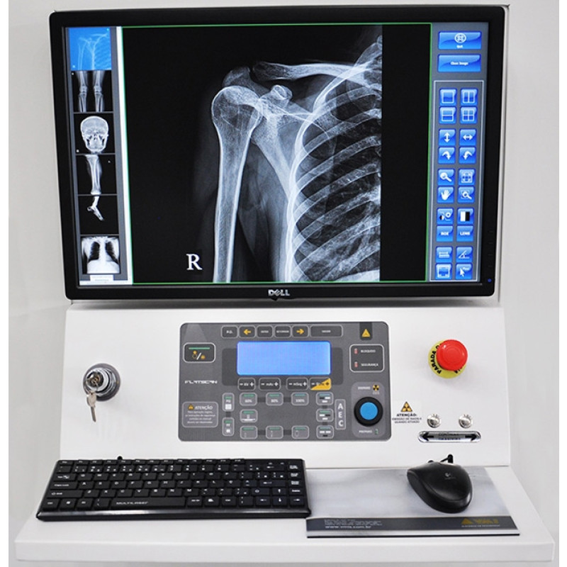 Controles De Acesso E Biometria Gerador De Laudos Periciais Por Analise De Imagens Digitais Flatscandf80 Controles De Acesso E Biometria